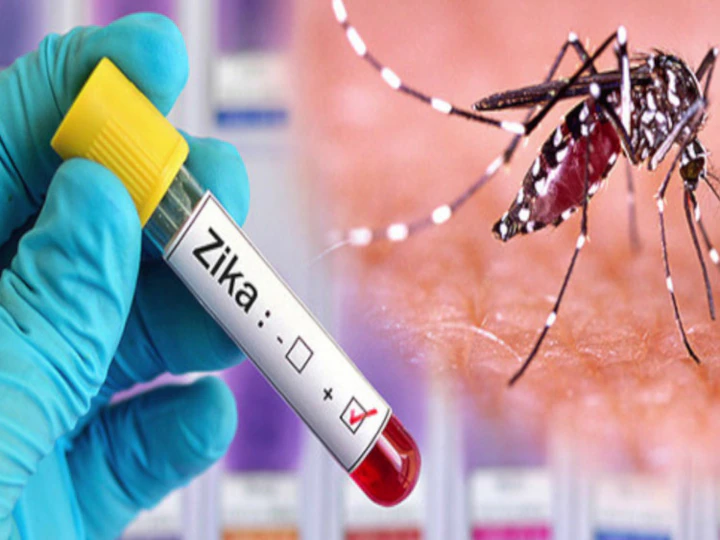 Zika Virus